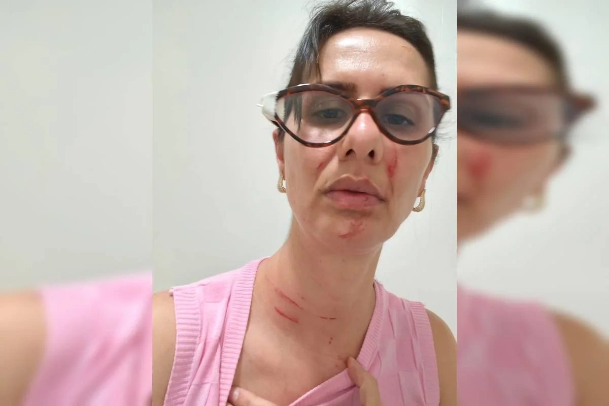 Enfermeira é agredida por paciente dentro de hospital público no Distrito Federal