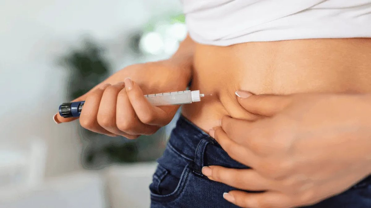 Estudo aponta possível relação entre medicamentos para emagrecer e calvície masculina