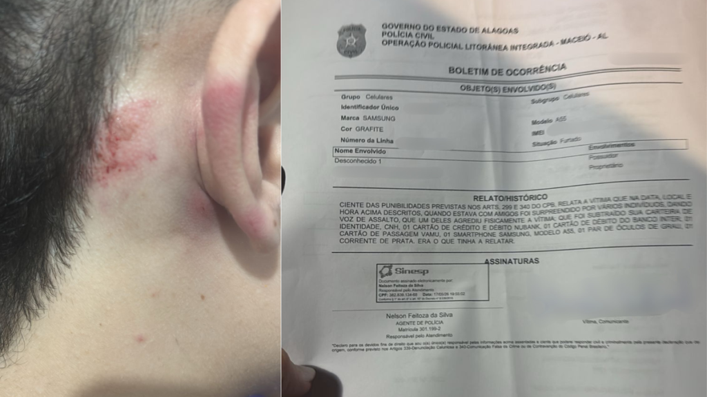 Grupo é cercado, espancado e roubado durante arrastão na areia da Ponta Verde